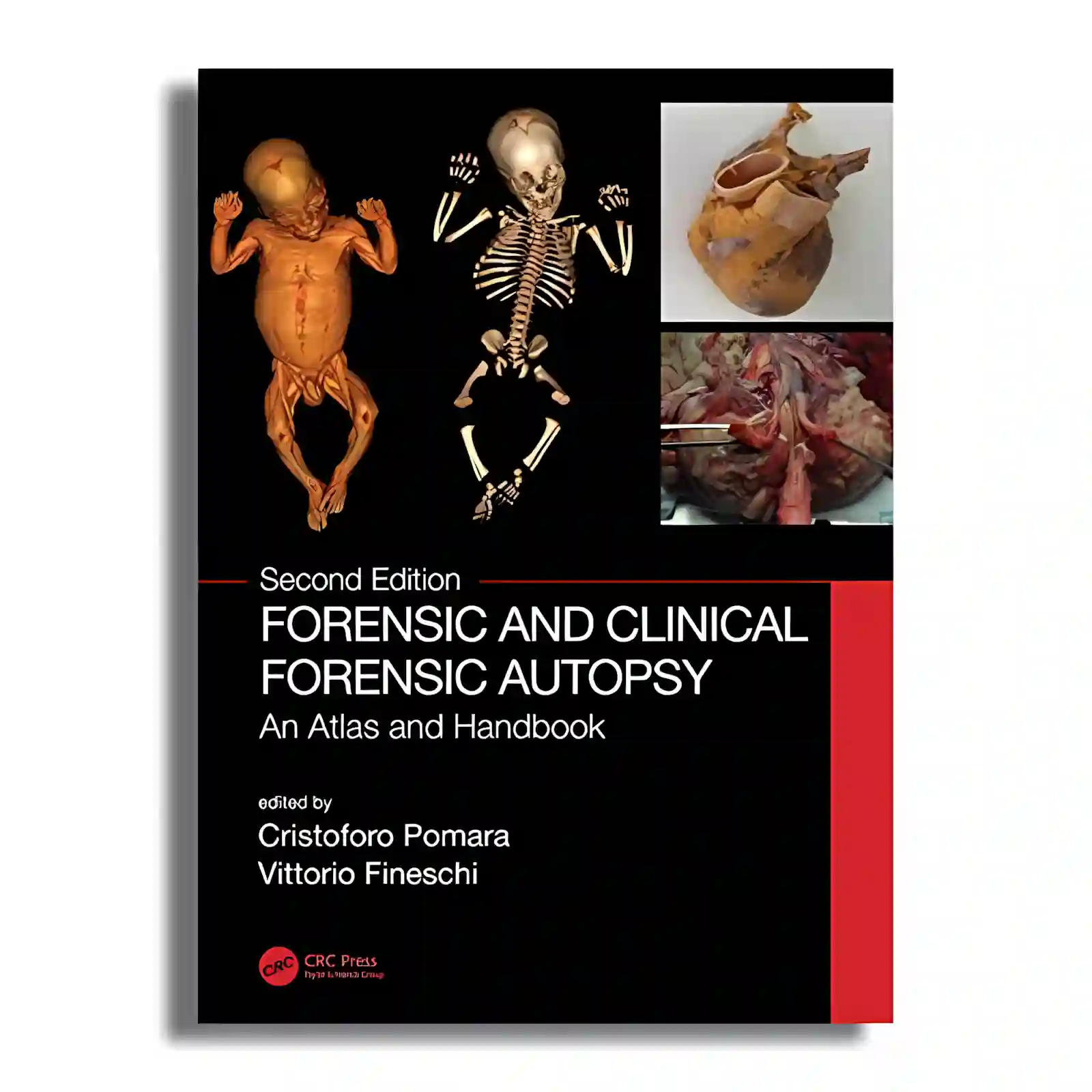 Forensic and Clinical Forensic Autopsy: An Atlas and Handbook, 2nd Edition