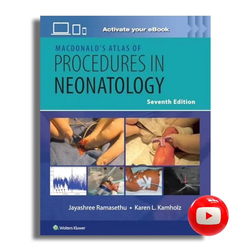MacDonald’s Atlas of Procedures in Neonatology