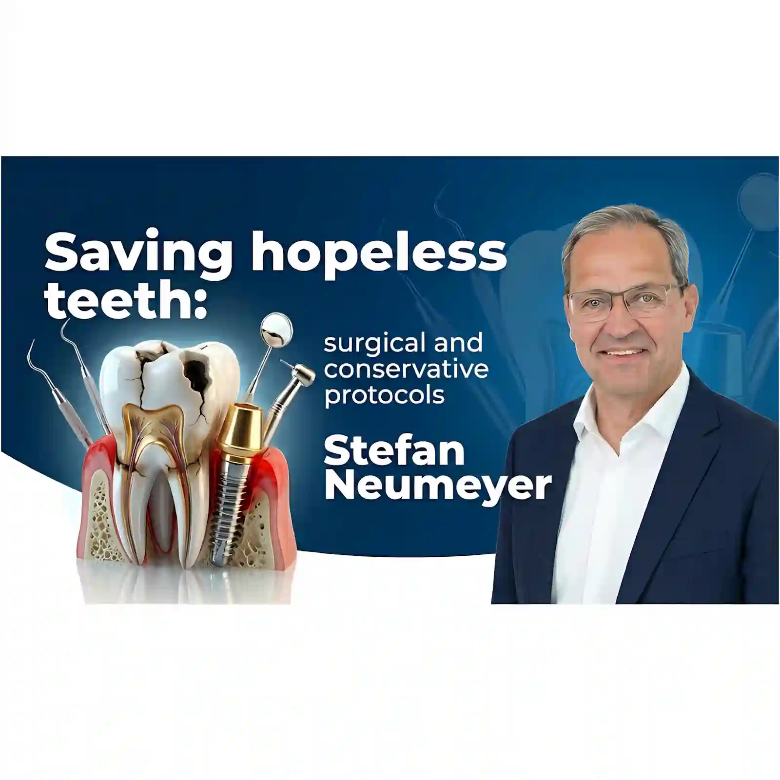 OHI-S Saving Hopeless Teeth, Surgical and Conservative Protocols    